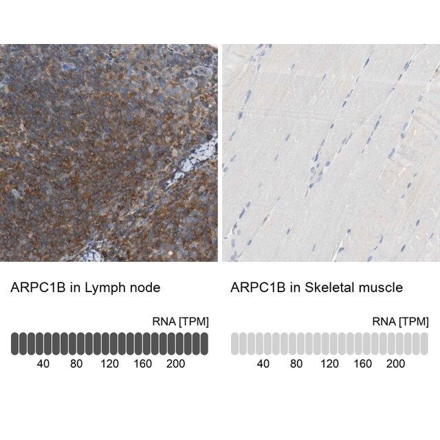 Anti-ARPC1B antibody produced in rabbit