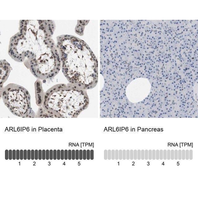 Anti-ARL6IP6 antibody produced in rabbit