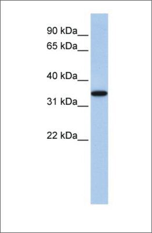 Anti-ART4 antibody produced in rabbit