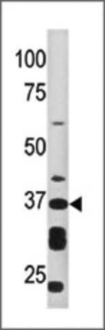 Anti-ART1 (N-term) antibody produced in rabbit