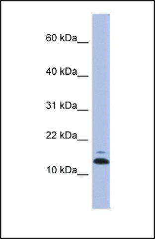 Anti-ASAH1, (N-terminal) antibody produced in rabbit