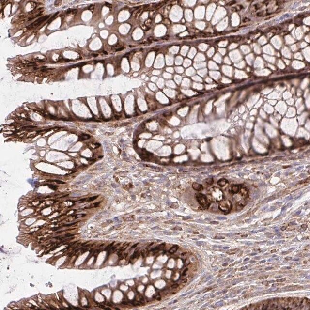 Anti-ASAP1 antibody produced in rabbit