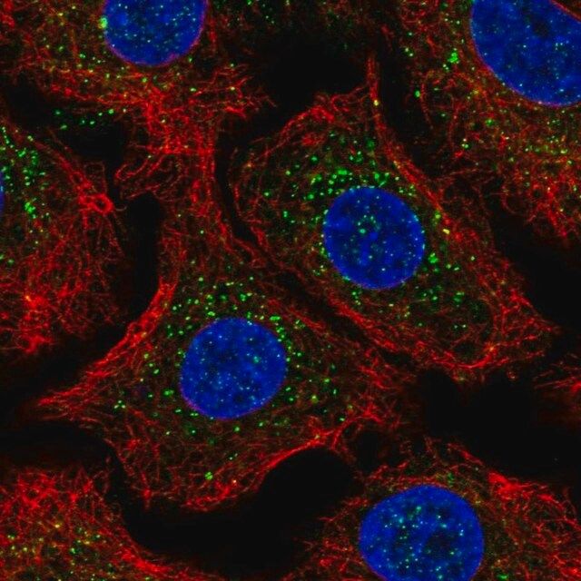 Anti-ARRB2 antibody produced in rabbit