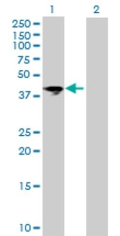 Anti-ART5 antibody produced in mouse