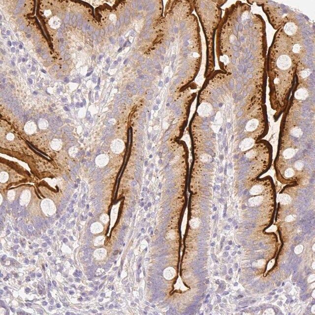 Anti-ASAH2 antibody produced in rabbit