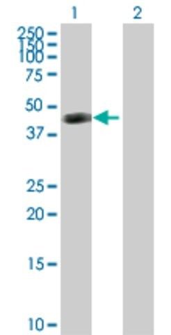 Anti-ART3 antibody produced in rabbit