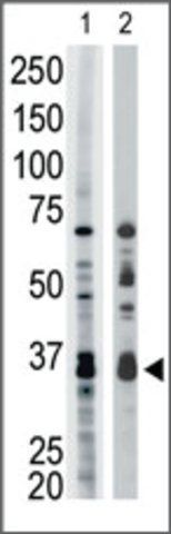 Anti-ART1 (center) antibody produced in rabbit