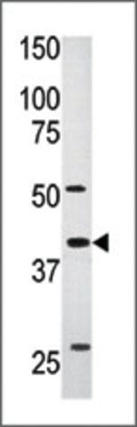 Anti-ART5 (C-term) antibody produced in rabbit