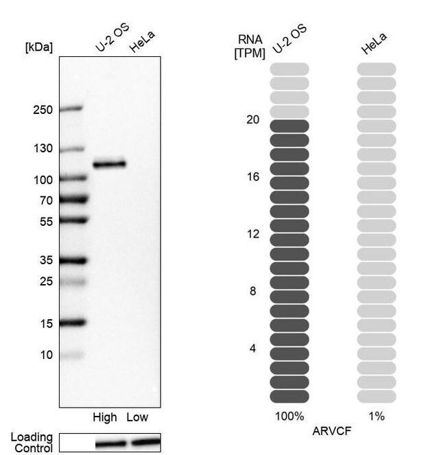 Anti-ARVCF antibody produced in rabbit