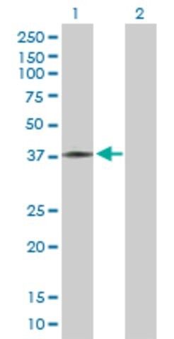 Anti-ART5 antibody produced in mouse