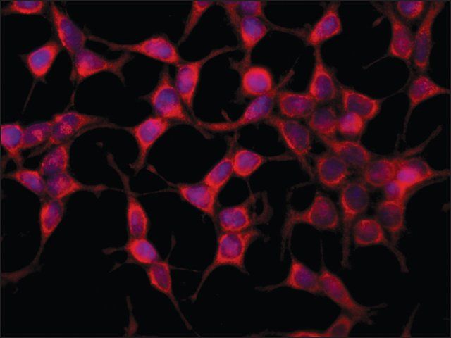 Anti-AS160 antibody produced in rabbit