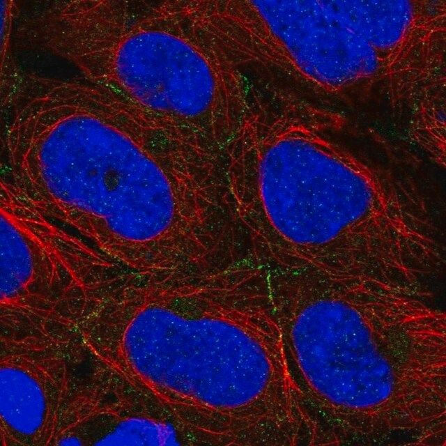 Anti-ARVCF antibody produced in rabbit