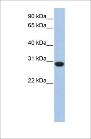 Anti-ASB12 antibody produced in rabbit