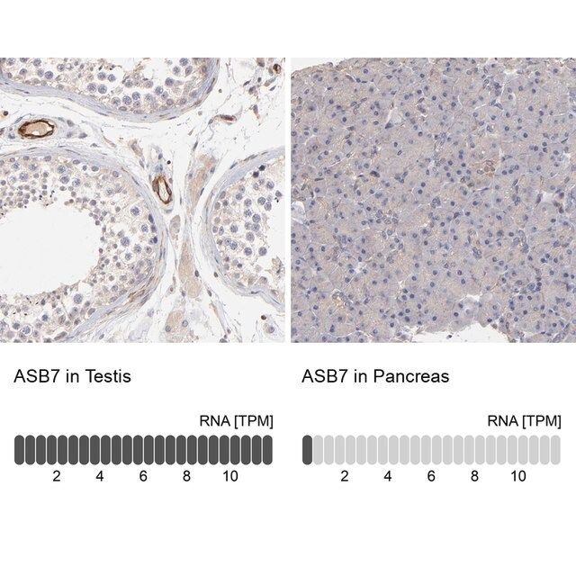 Anti-ASB7 antibody produced in rabbit