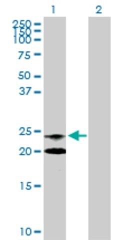 Anti-ASAHL antibody produced in rabbit