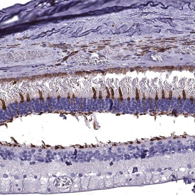 Anti-ARR3 antibody produced in rabbit