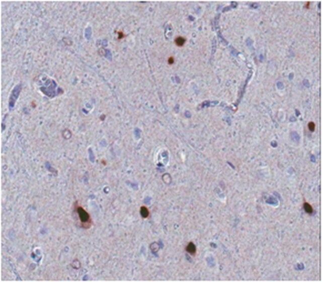 Anti-ARX Antibody, clone 11F6.2