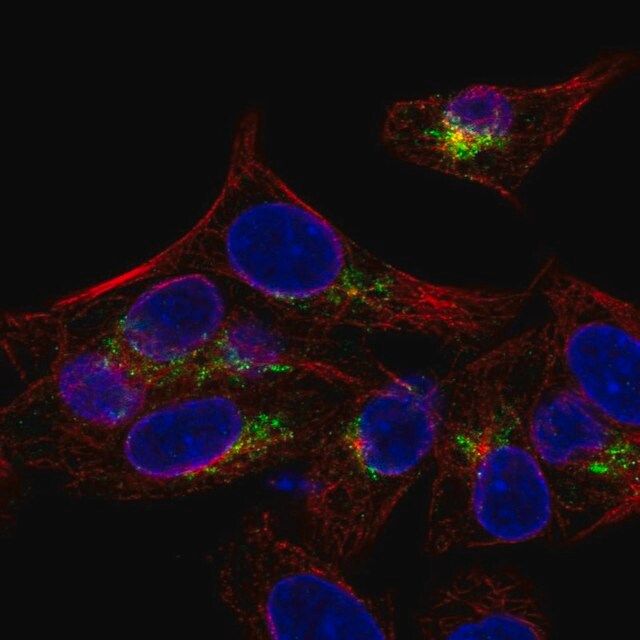 Anti-ARSE antibody produced in rabbit