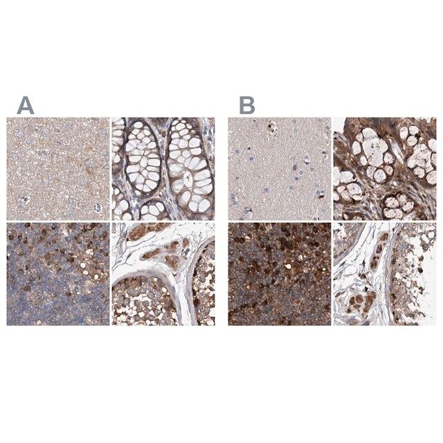 Anti-ASCC3 antibody produced in rabbit