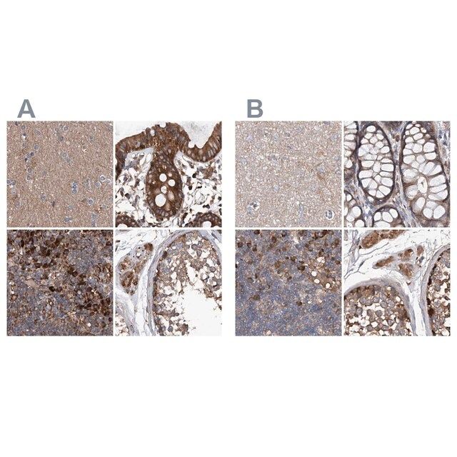 Anti-ASCC3 antibody produced in rabbit