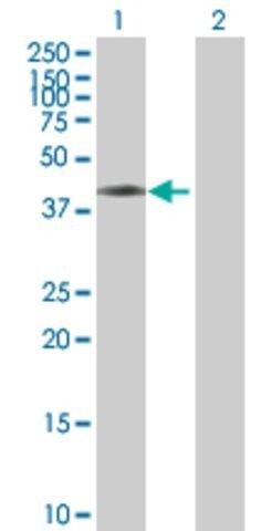 Anti-ASCC1 antibody produced in mouse