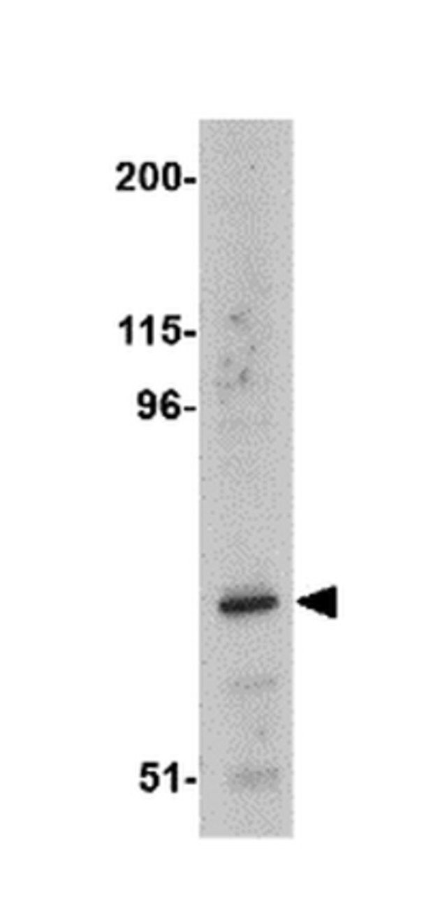 Anti-ASAH2 Antibody