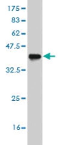 ANTI-ASCL1 antibody produced in mouse