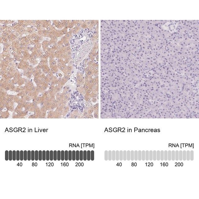 Anti-ASGR2 antibody produced in rabbit