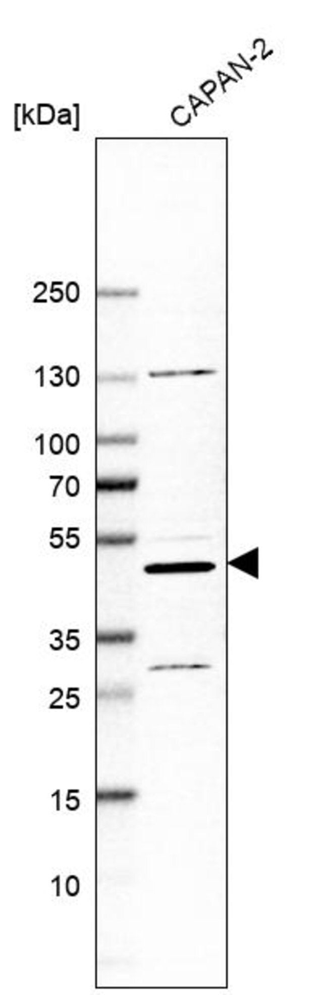 Anti-ASCC1 antibody produced in rabbit