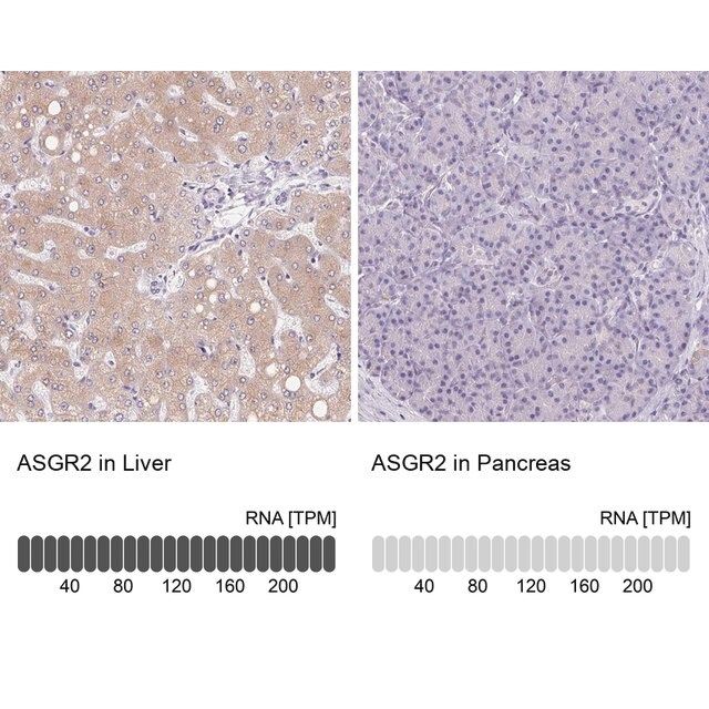 Anti-ASGR2 antibody produced in rabbit