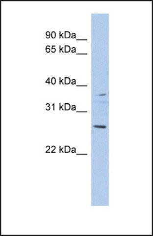 Anti-ASCL2 antibody produced in rabbit