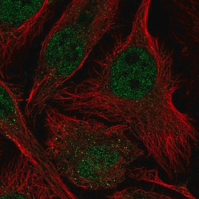 Anti-ASF1B antibody produced in rabbit