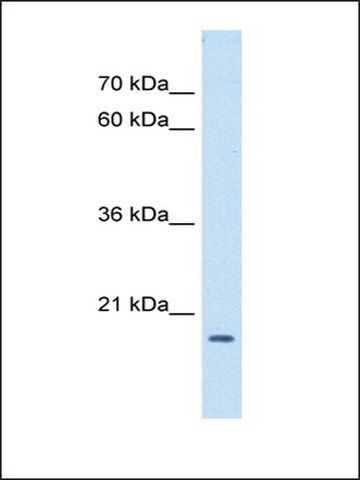 Anti-ASF1B antibody produced in rabbit