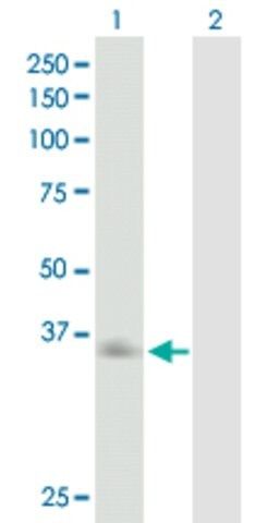 Anti-ASGR2 antibody produced in mouse