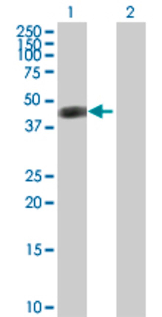 Anti-ASL antibody produced in rabbit