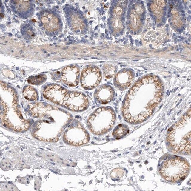 Anti-ASIC5 antibody produced in rabbit