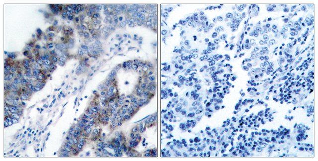 Anti-ASK1 antibody produced in rabbit