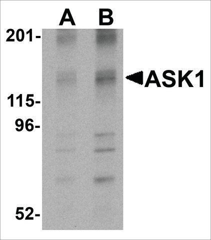 Anti-ASK1 (ab3) antibody produced in rabbit