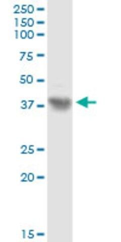 Anti-ASPN antibody produced in rabbit