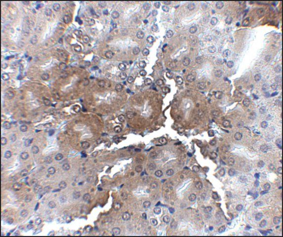 Anti-AP2M1 antibody produced in chicken