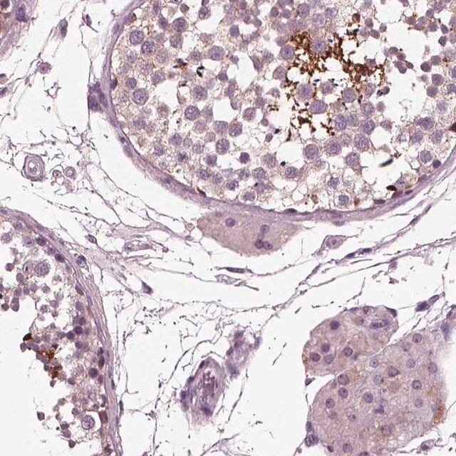 Anti-AP4M1 antibody produced in rabbit