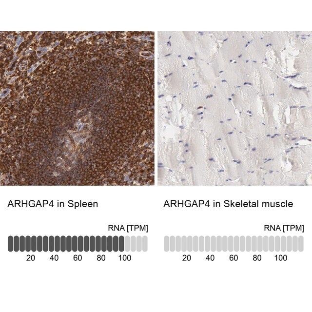 Anti-ARHGAP4 antibody produced in rabbit