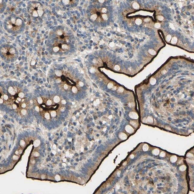 Anti-ARHGAP1 antibody produced in rabbit