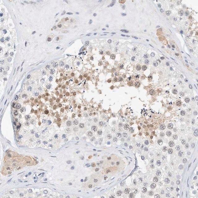 Anti-ARHGAP28 antibody produced in rabbit