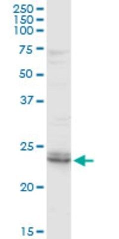 Anti-ARHGDIB antibody produced in rabbit