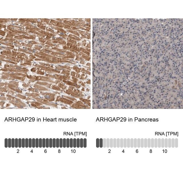 Anti-ARHGAP29 antibody produced in rabbit