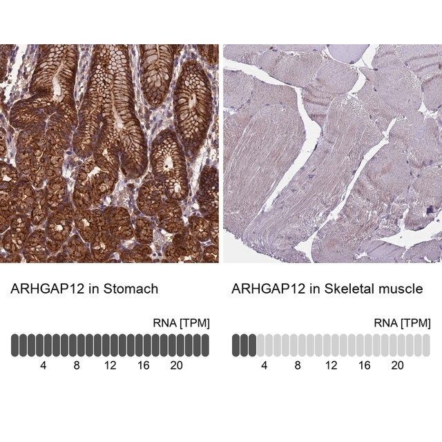 Anti-ARHGAP12 antibody produced in rabbit