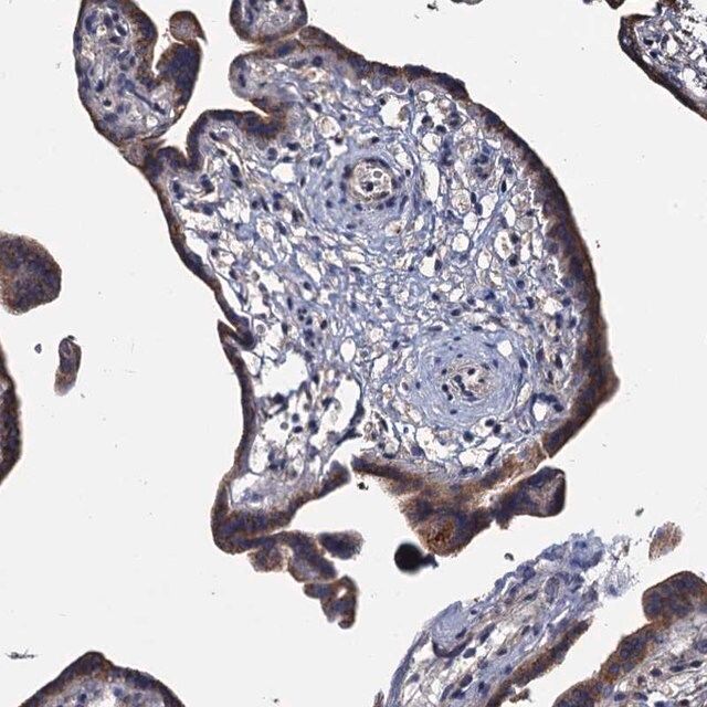 Anti-ARHGAP42 antibody produced in rabbit