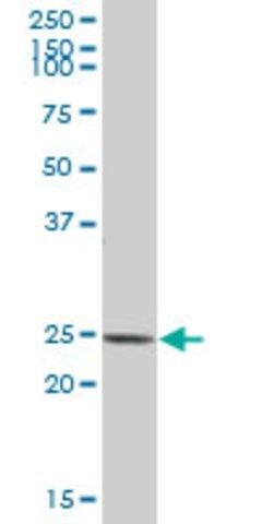 Anti-ARHGDIB antibody produced in mouse