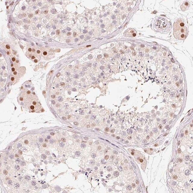 Anti-ARHGAP22 antibody produced in rabbit